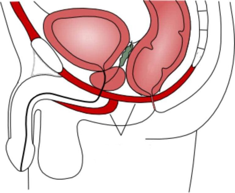 entrenar los músculos del suelo pélvico para mejorar la potencia